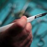 Что такое обрезание и зачем его делают мальчикам: показания к операции и особенности ухода после процедуры